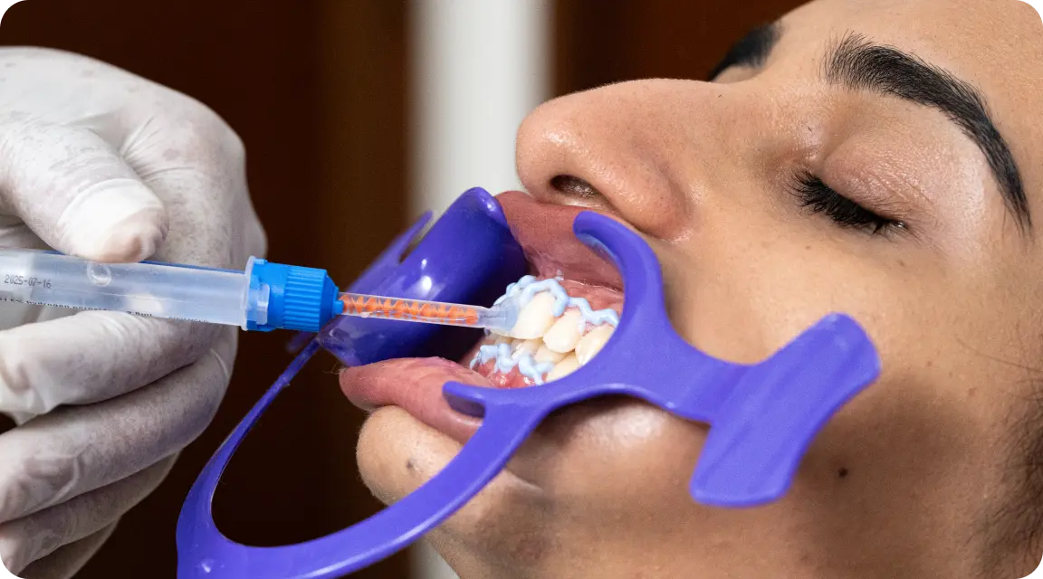 Whitening Application